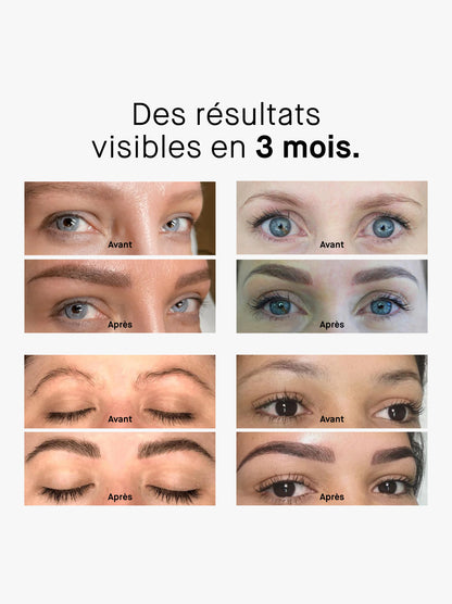 ROSEBROW ADVANCED