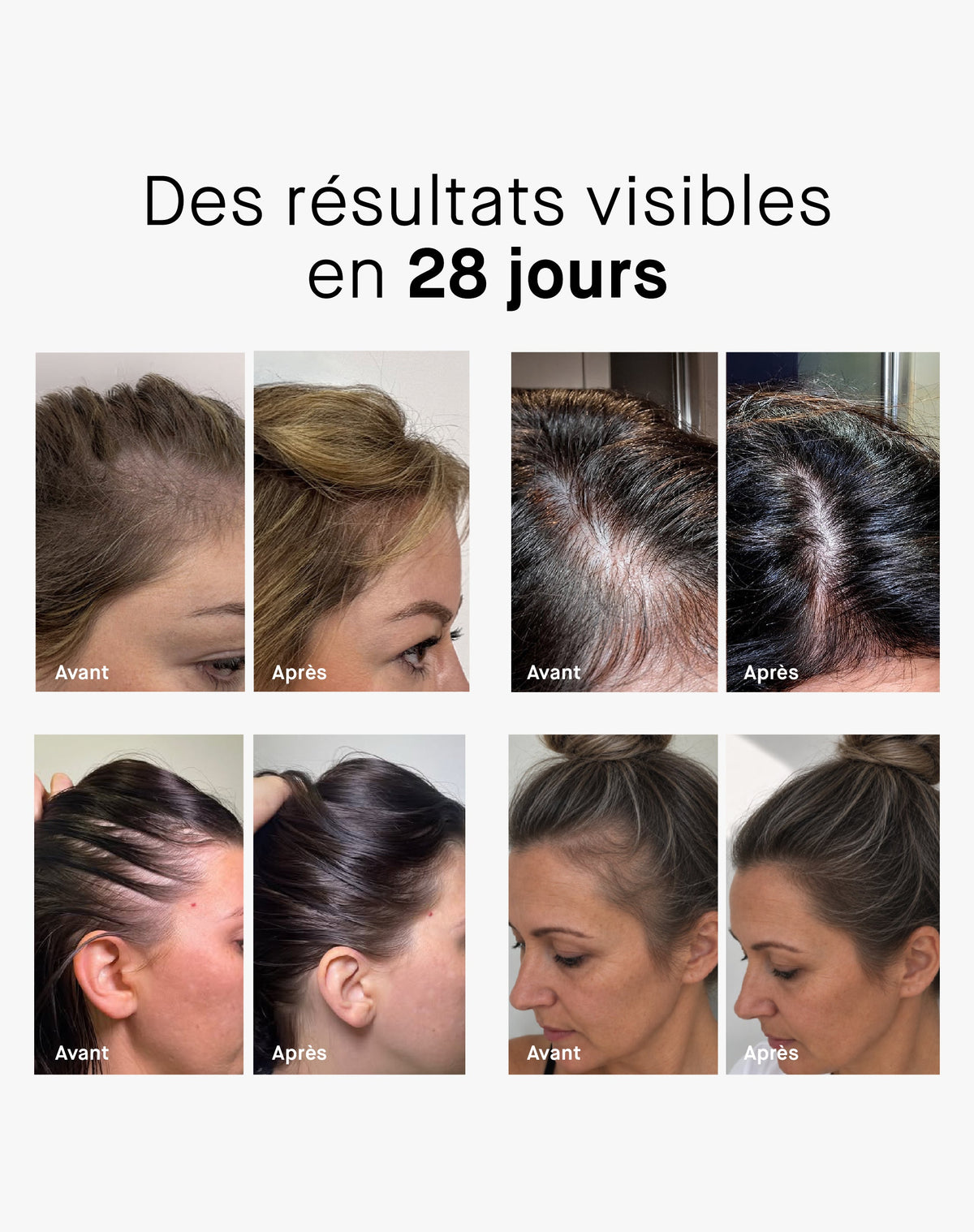 ROSEHAIR ADVANCED