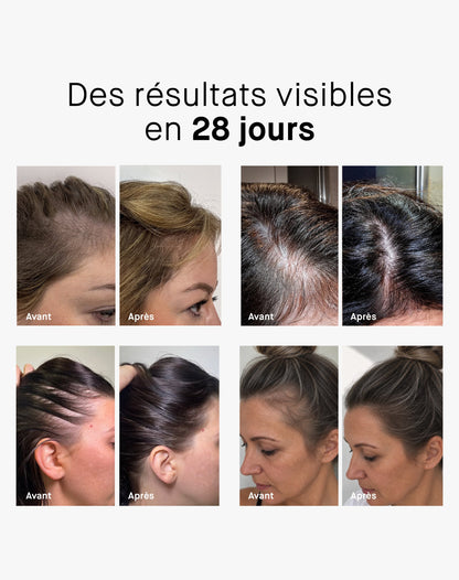 ROSEHAIR ADVANCED